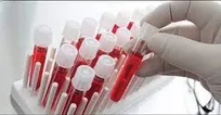 سرپرست جهاد دانشگاهی البرز با اشاره به لزوم آگاه‌سازی جامعه درباره مزایای ذخیره خون بند ناف، گفت: نمایندگی بانک خون بند ناف رویان در البرز تاکنون موفق به ذخیره پنج هزار نمونه شده است.